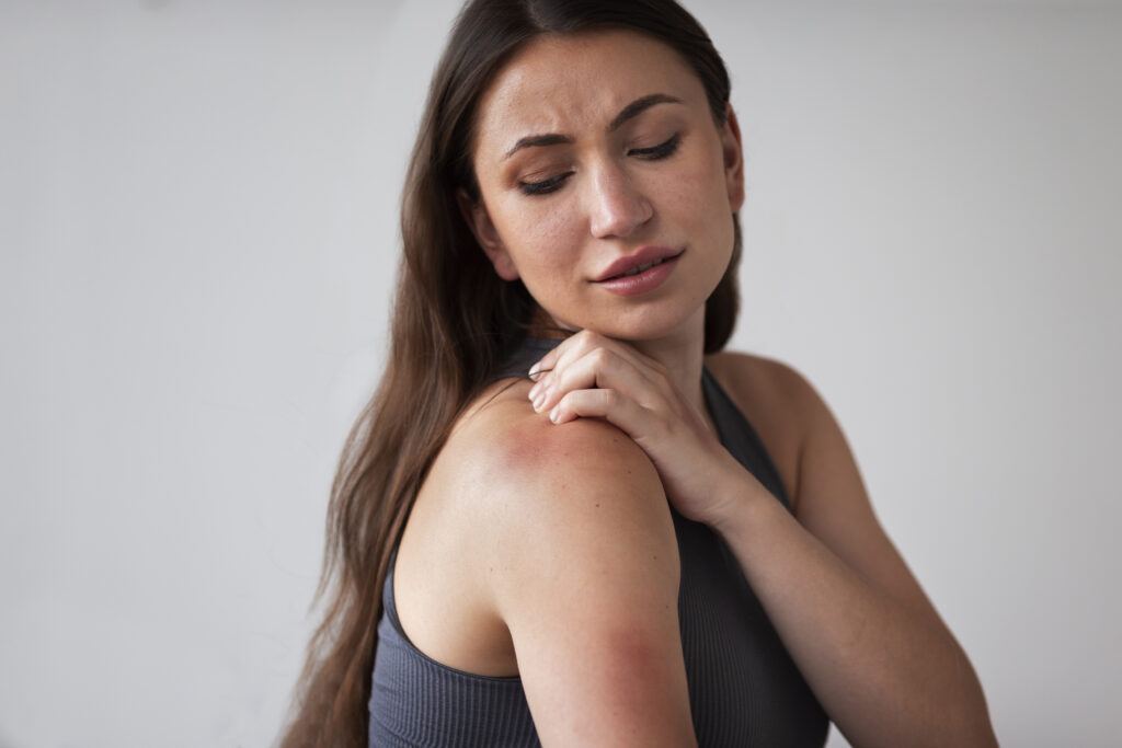 Woman with long brown hair grimacing and touching her reddened, irritated shoulder