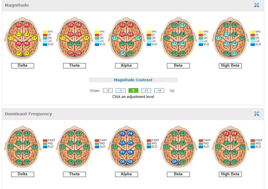 EEG brain maps showing magnitude and dominant frequency across delta, theta, alpha, beta and high beta bands